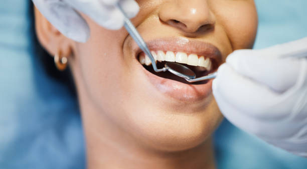 Best Emergency Root Canal Treatment in Sturgis, MI